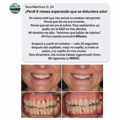 Polvo de Colágeno para Encías