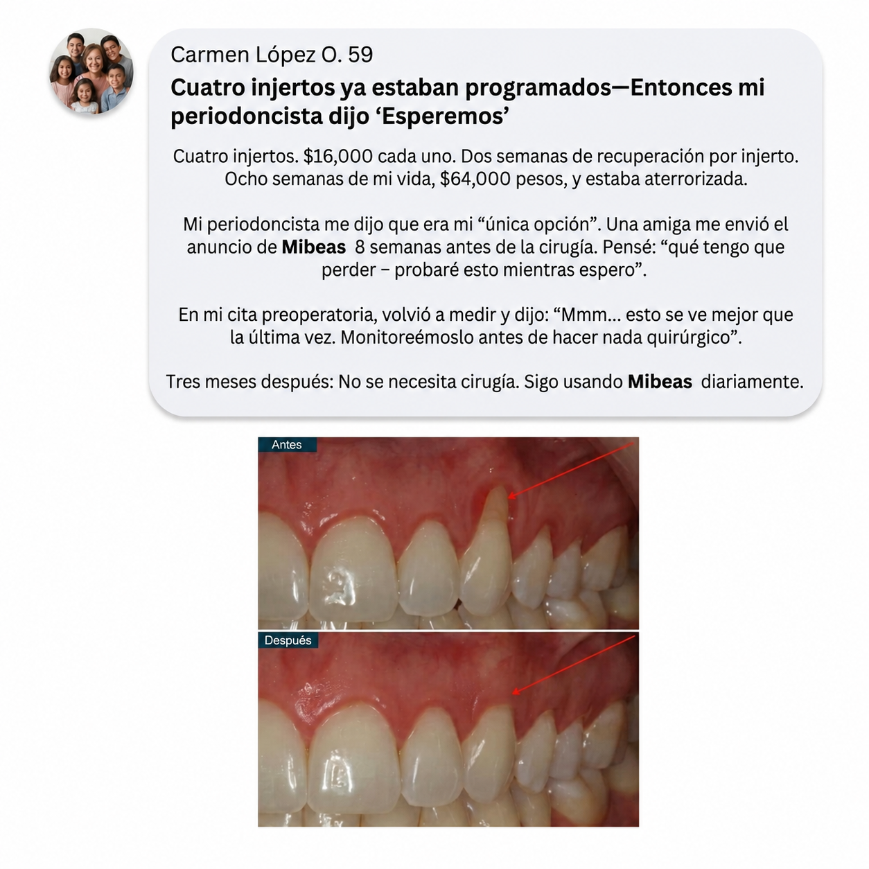 Polvo de Colágeno para Encías